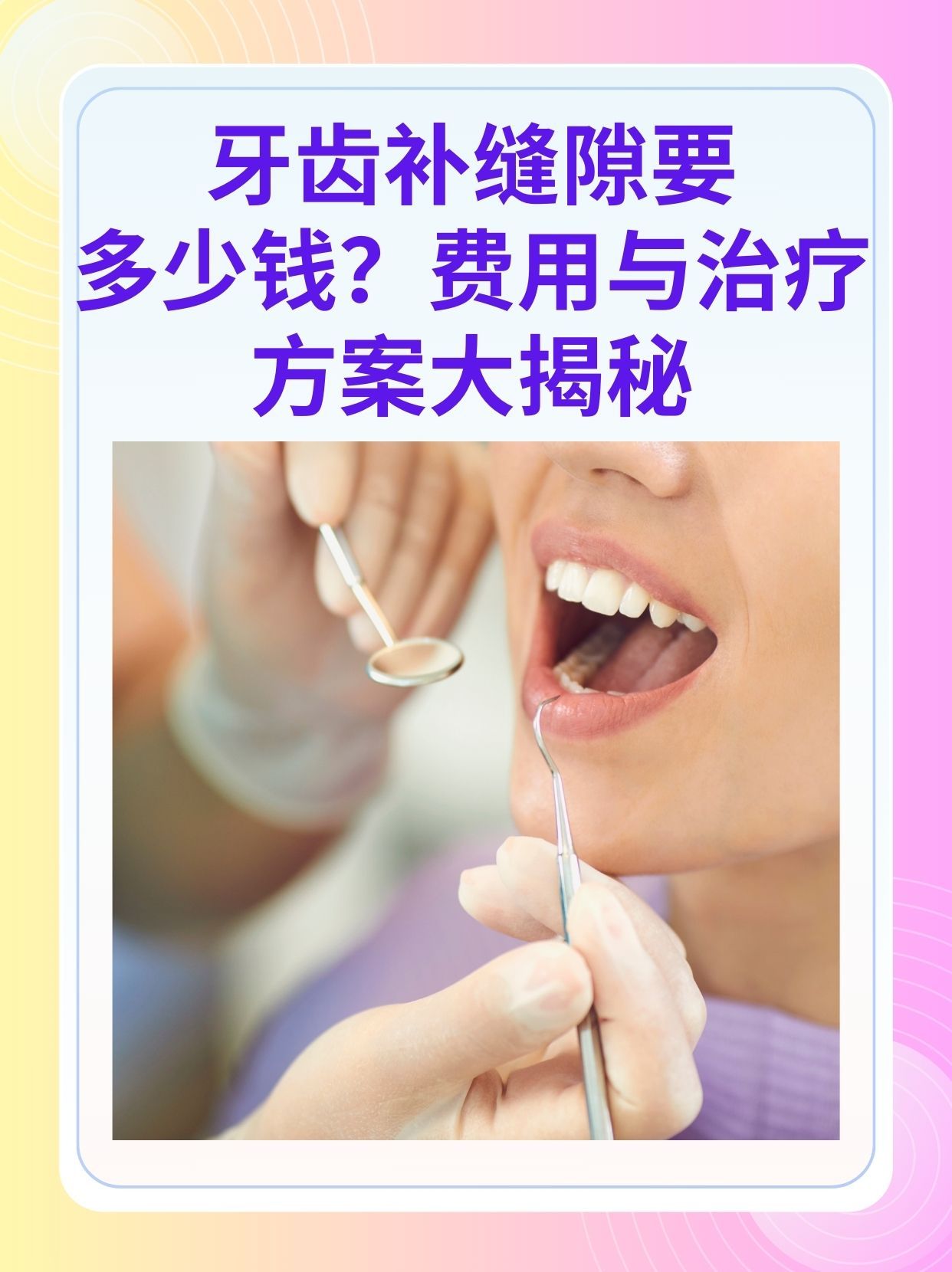 北海补牙医保可以报销吗(补牙医保可以报销吗 哪些可以报销呢)